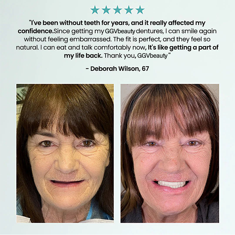 🦷 Fit Full Functional Dentures Make you more confident