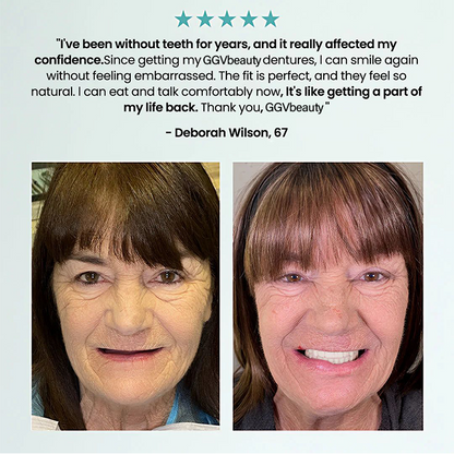 🦷 Fit Full Functional Dentures Make you more confident