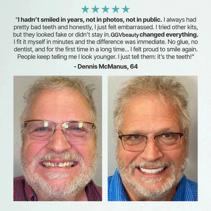 🦷 Fit Full Functional Dentures Make you more confident