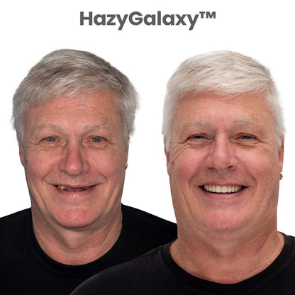 ✅🦷 HazyGalaxy™ Custom-Fit Dentures ⏰ ENDS TODAY   70% OFF | Smile with Confidence