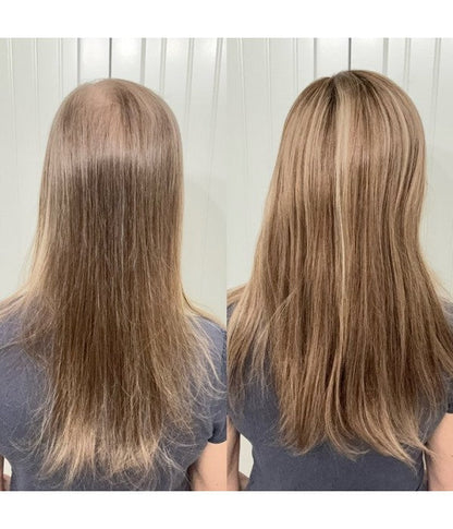 ☀️ Hot Weather? Try This Breathable Hair Solution-Natural-Looking Hair Topper for Women