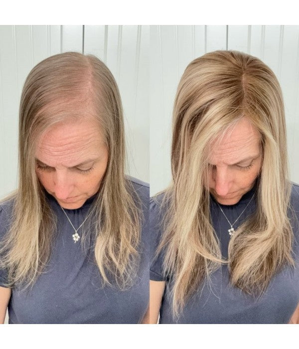 ☀️ Hot Weather? Try This Breathable Hair Solution-Natural-Looking Hair Topper for Women
