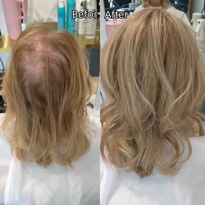 🌷Final Hours –🌷2026 New Lightweight & Breathable Wavy Hair Topper